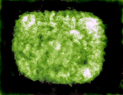 Image:Poxvirus.jpg