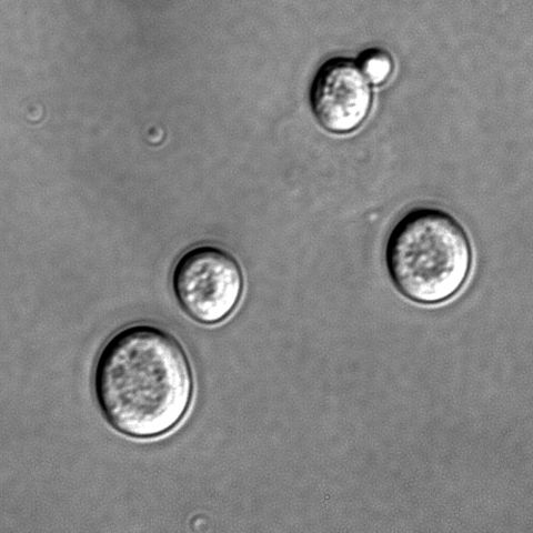 Image:S cerevisiae under DIC microscopy.jpg