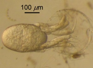 Image:Nauplius Hatching.jpg