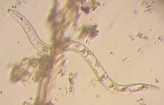 Image:Roundworm.jpg