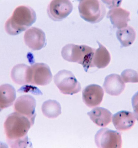 Image:Plasmodium.jpg
