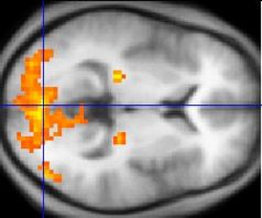 A scan of the brain using fMRI
