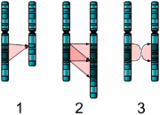 Deletion (1), duplication (2) and inversion (3) are all chromosome abnormalities that have been implicated in autism.