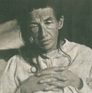 Auguste D, first described patient with AD by Al&ouml;is Alzheimer in 1901