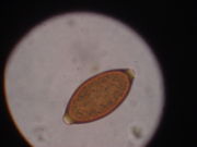 Egg of Trichuris vulpis